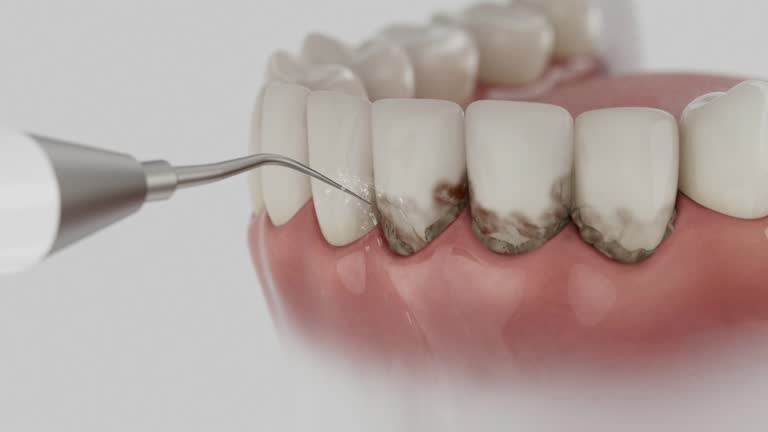 Trusted Emergency Dentist service in Edgewood, OH - Dentist Open Now